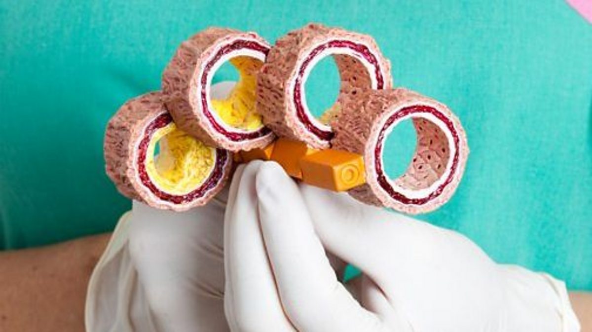 Health, diseases and micro-organisms: Non-communicable diseases (CCEA)