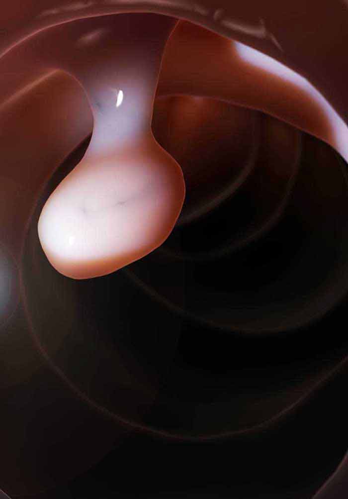 Advanced Endoscopy