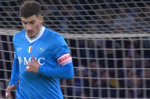 Napoli VS Atlanta Highlight