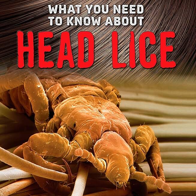 What You Need to Know About Head Lice