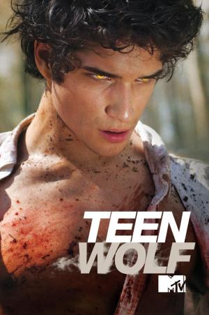Teen Wolf - 123Movies