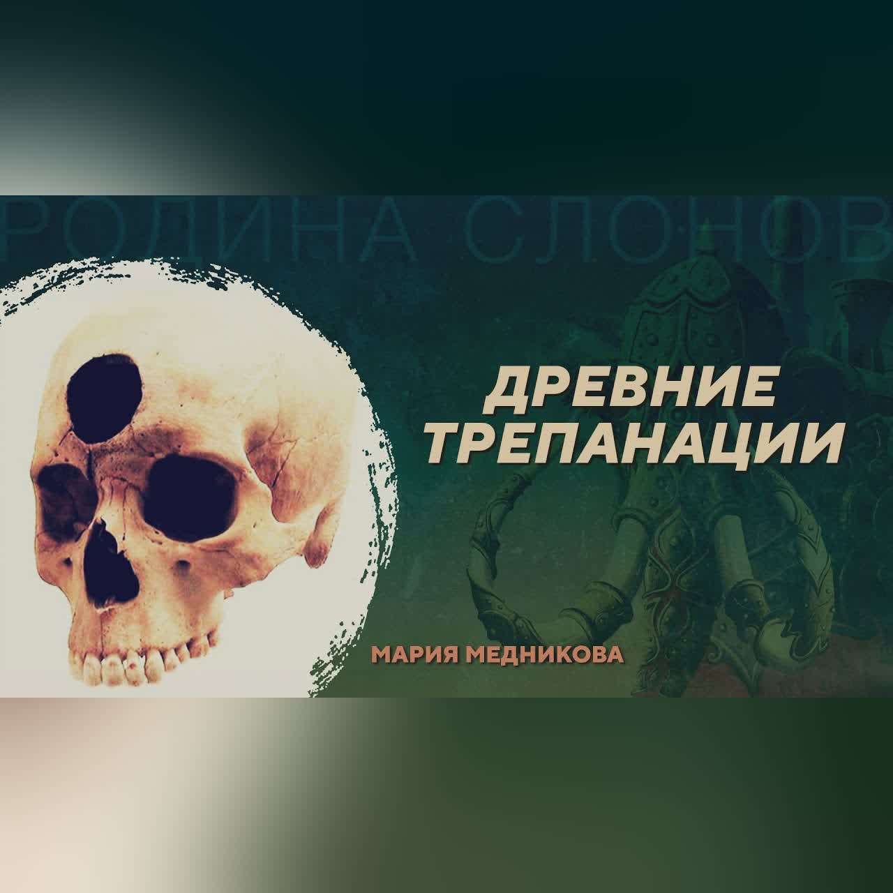 Древние трепанации. Мария Медникова. Родина слонов №45