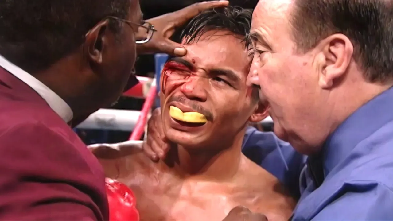 ESTE TIPO QUERIA DESTRUIR A MANNY PACQUIAO SIN MEDIR CONSECUENCIAS