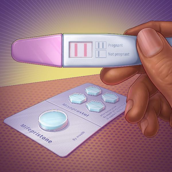 Medication Abortion Using Mifepristone and Misoprostol