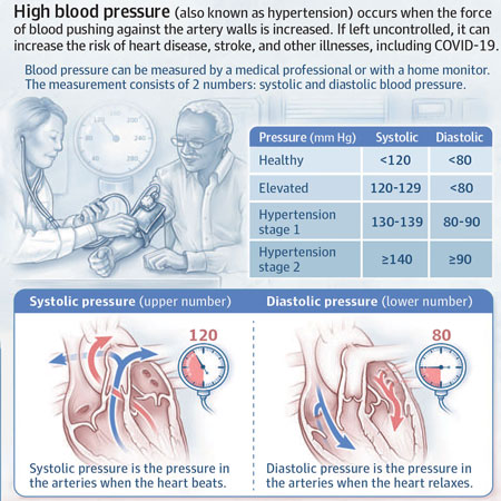 USPSTF Recommendation: Screening for Hypertension in Adults