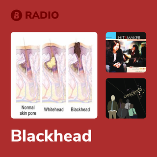 Blackhead Radio