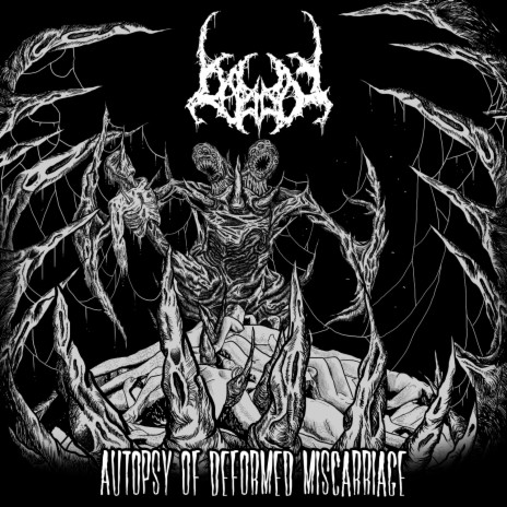 Autopsy of Deformed Masarriage