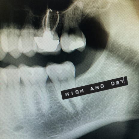 High And Dry cover art