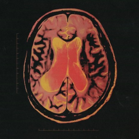 nightmares live in my thoughts cover art