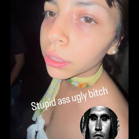 U GOT UR ASS BEAT LOL!! EMMY UR A BITCH cover art