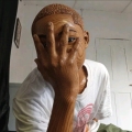 Ras aq