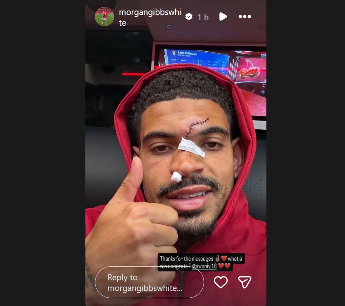 doc-content image