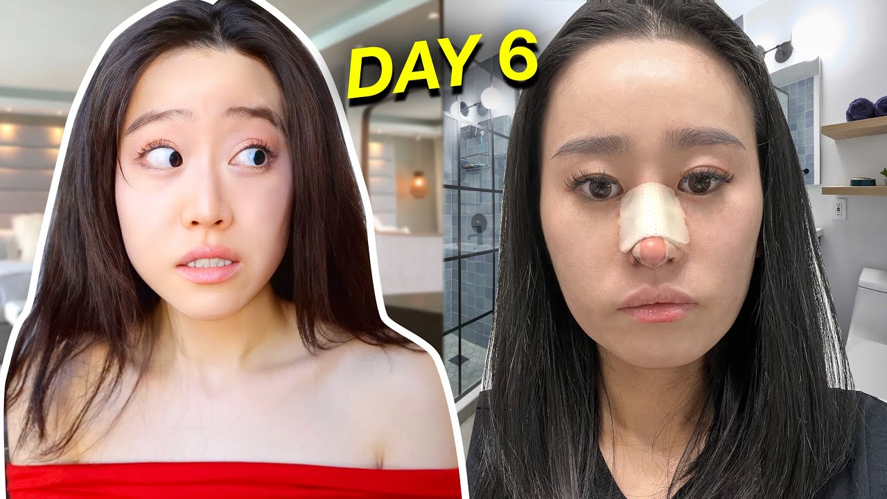 MY SISTER GOT A NOSE JOB!! cover art
