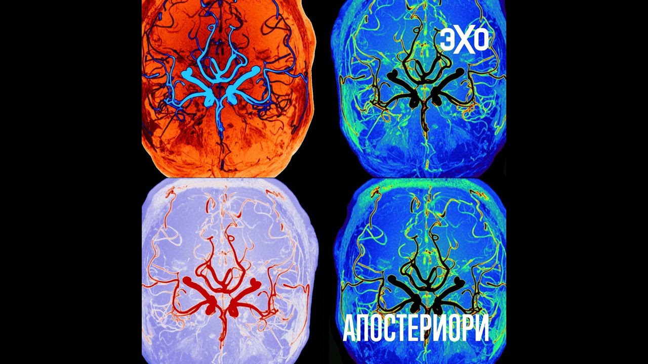 Учёные выяснили, что во сне мозг работает по другим правилам cover art
