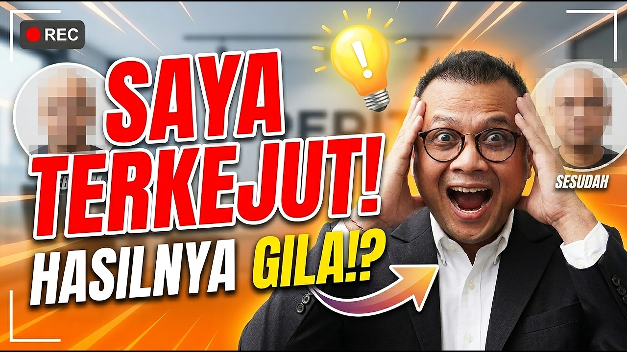Proses Tanam Rambut! BEFORE-AFTER: Hasilnya Bikin Syok!?😱 cover art