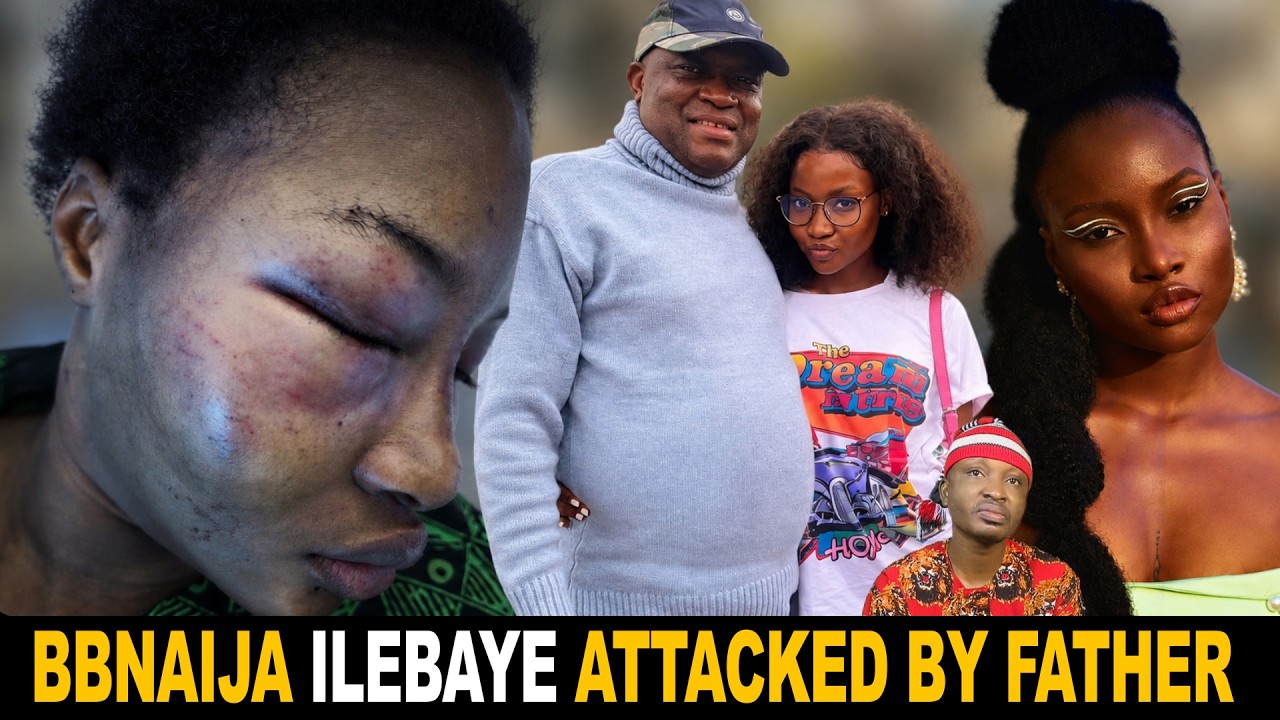 BBNaija Winner Ilebaye Attacked By Her Father Left With Black Eye cover art