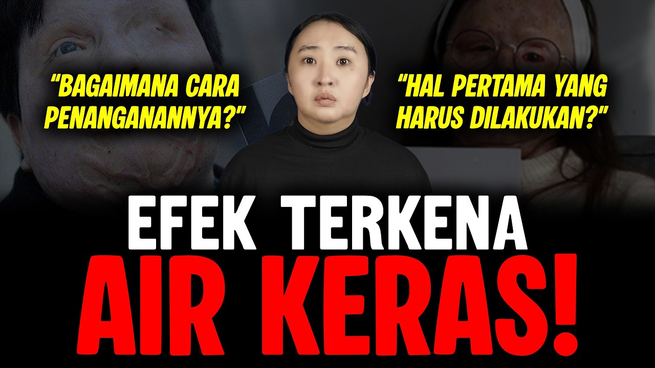 FAKTA MEDIS: EFEK SIRAMAN AIR KER4S PADA TUBUH MANUSIA cover art