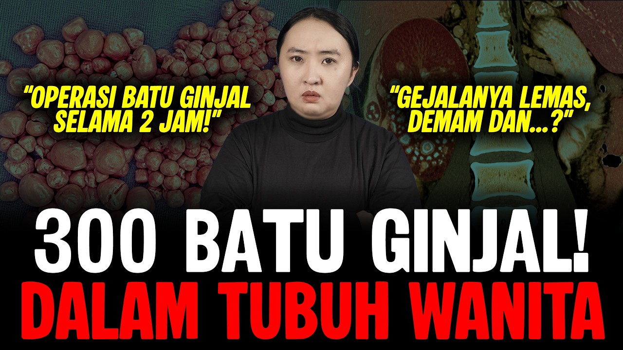 AKIBAT JARANG MINUM AIR PUTIH cover art