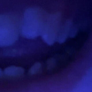 CANINES