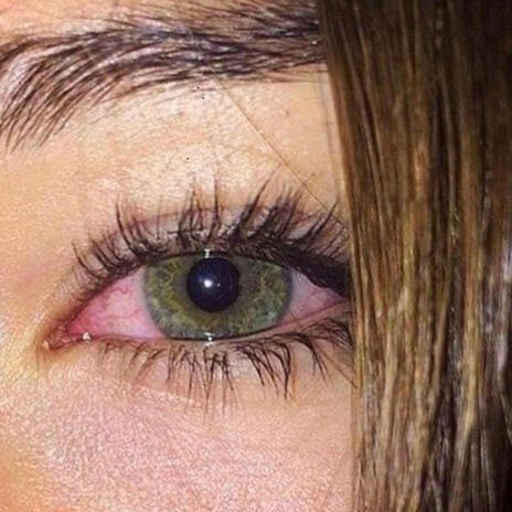 Augen Rot cover art