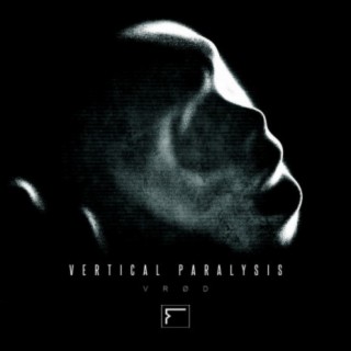 Vertical Paralysis