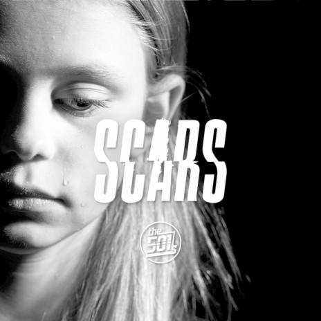 Scars