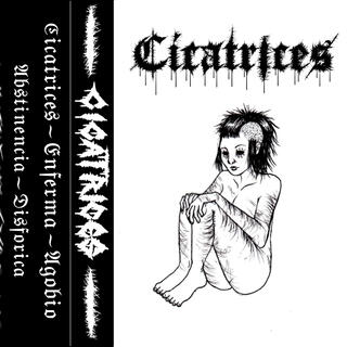 Cicatrices
