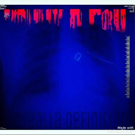 Thin Line ft. NewOrleansOwn D. Strong & 9th ward Bee Streets cover art
