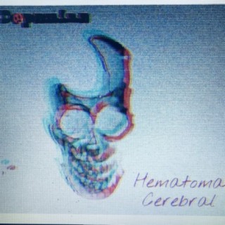 Hematoma Cerebral
