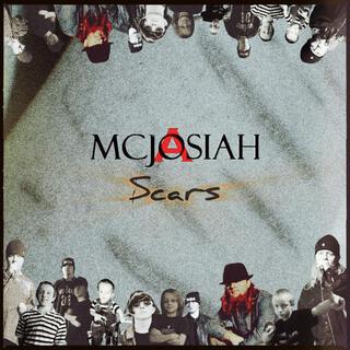 Scars