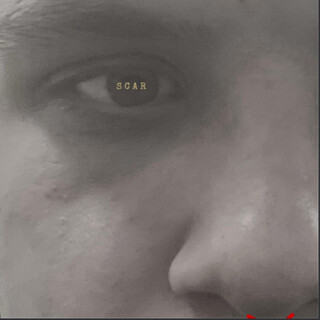 Scar