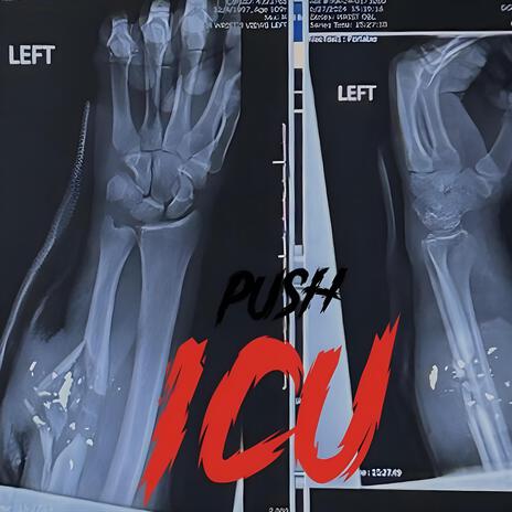 ICU cover art