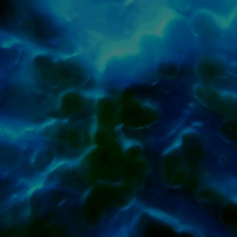 Take 4-6 (Between Exicel) cover art