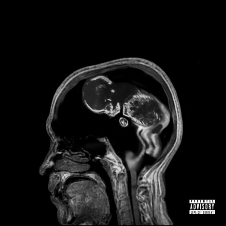 Interlude cover art