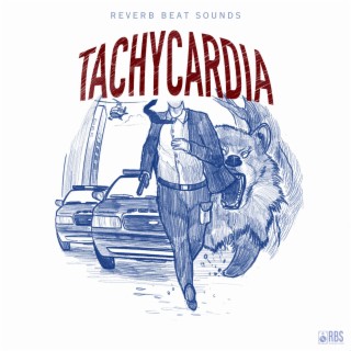 Tachycardia