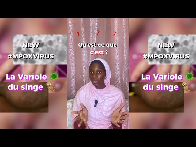 MonkeyPox ou Variole du singe : C’est quoi ? (Doit-on s’inquiéter ?) - Wolof Vostfr cover art