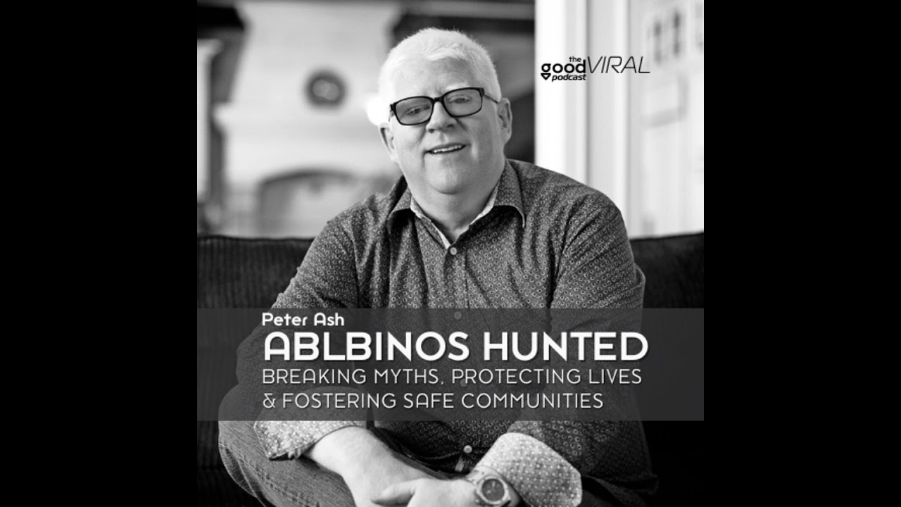 Hunted for Superstition: The Fight to Protect People with Albinism | Peter Ash & Under the Same Sun cover art