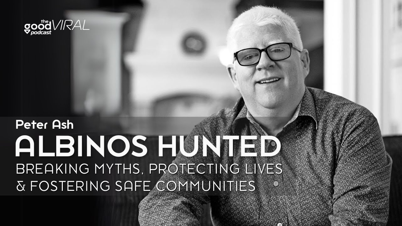 Hunted for Superstition: The Fight to Protect People with Albinism | Peter Ash & Under the Same Sun cover art