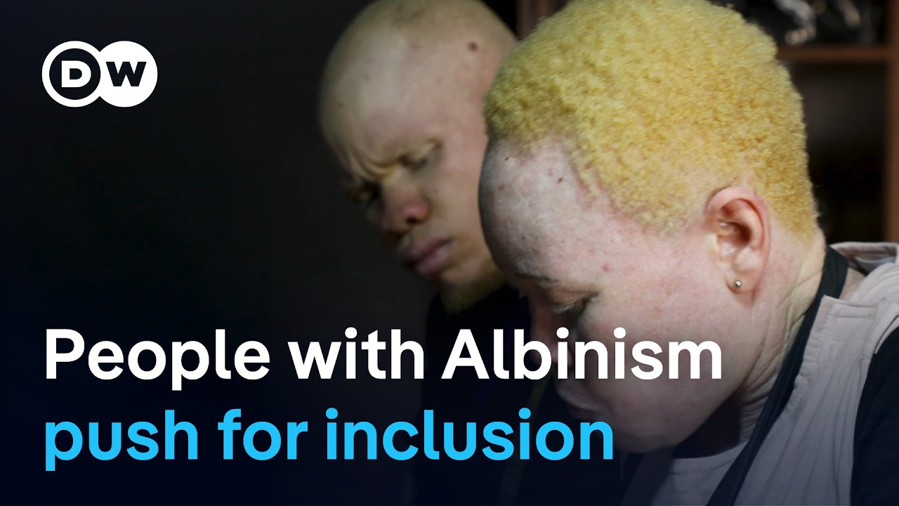 Nigeria: People with Albinism seek equal opportunities