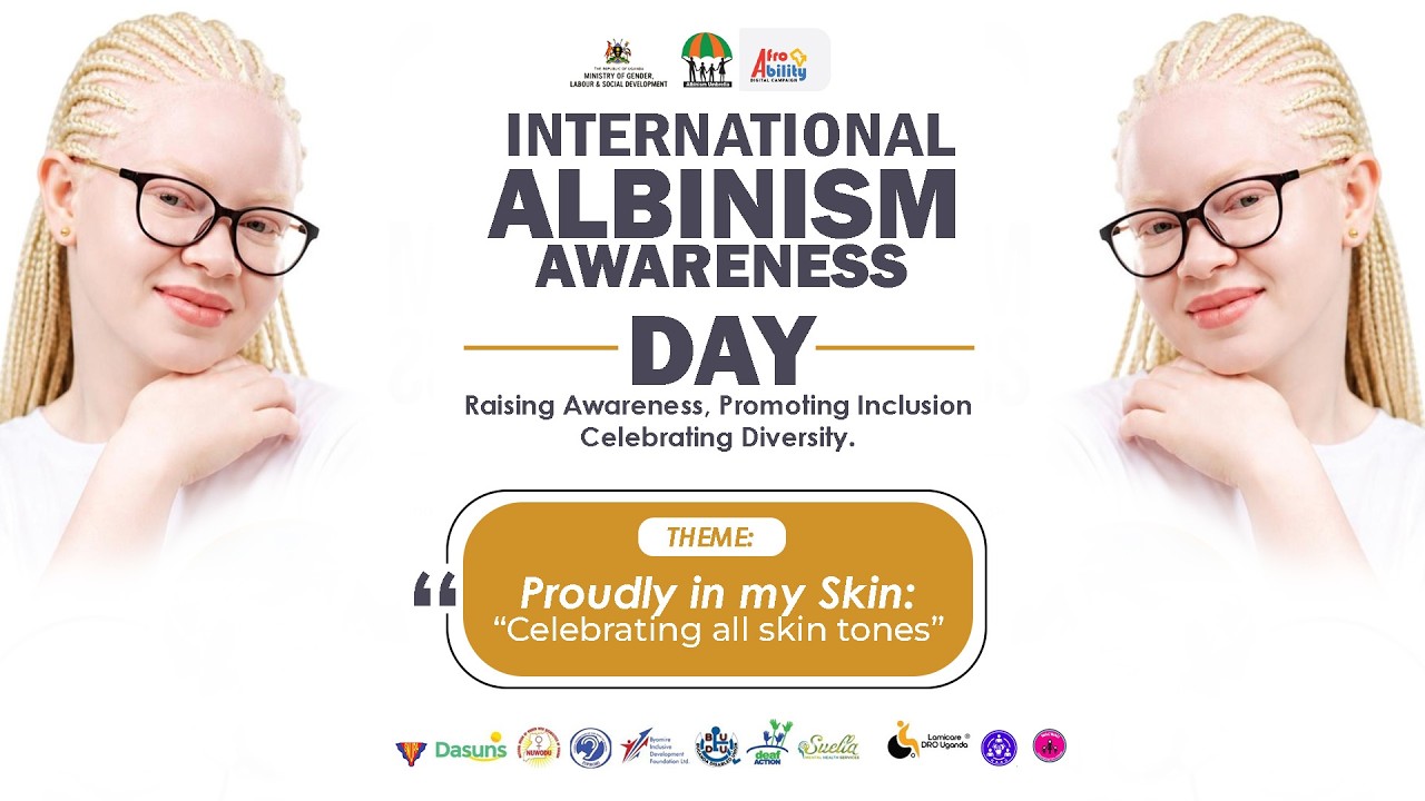 International Albinism awareness Day cover art