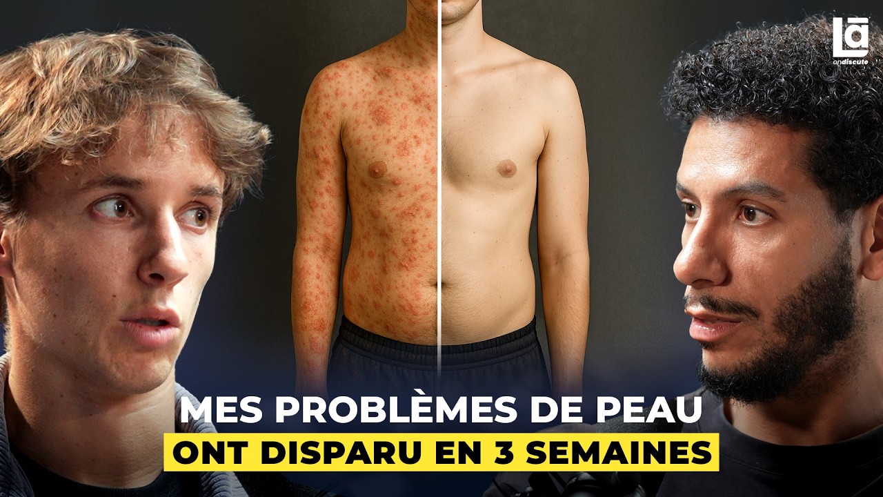 L'alimentation anti-inflammatoire a changé ma vie - Mat Resume cover art