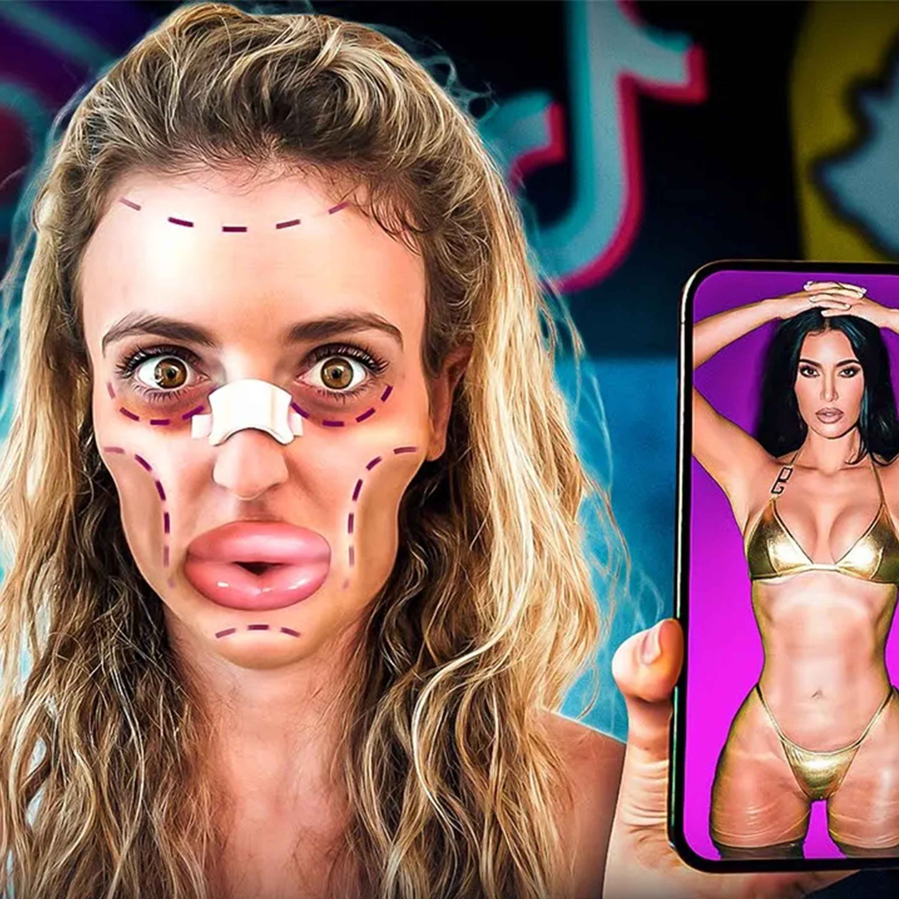 Gen Z : La génération accro à la Chirurgie Esthétique qui inquiète cover art