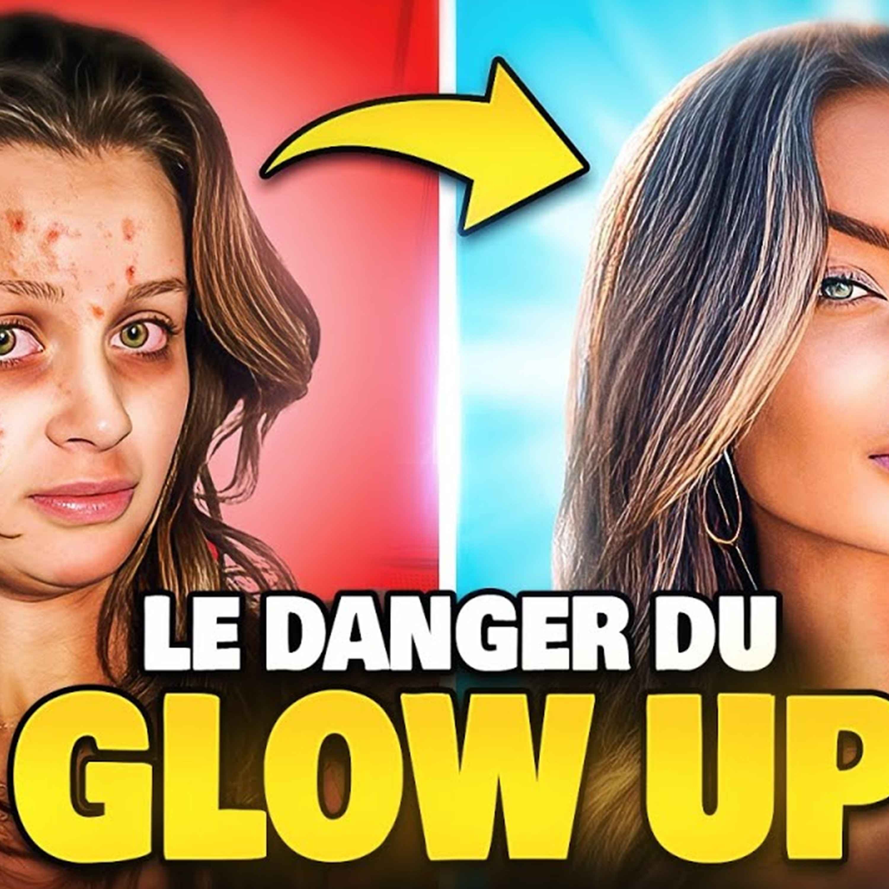 Les vidéos « Glow Up » sont DANGEREUSES (ça peut ruiner ta vie) cover art