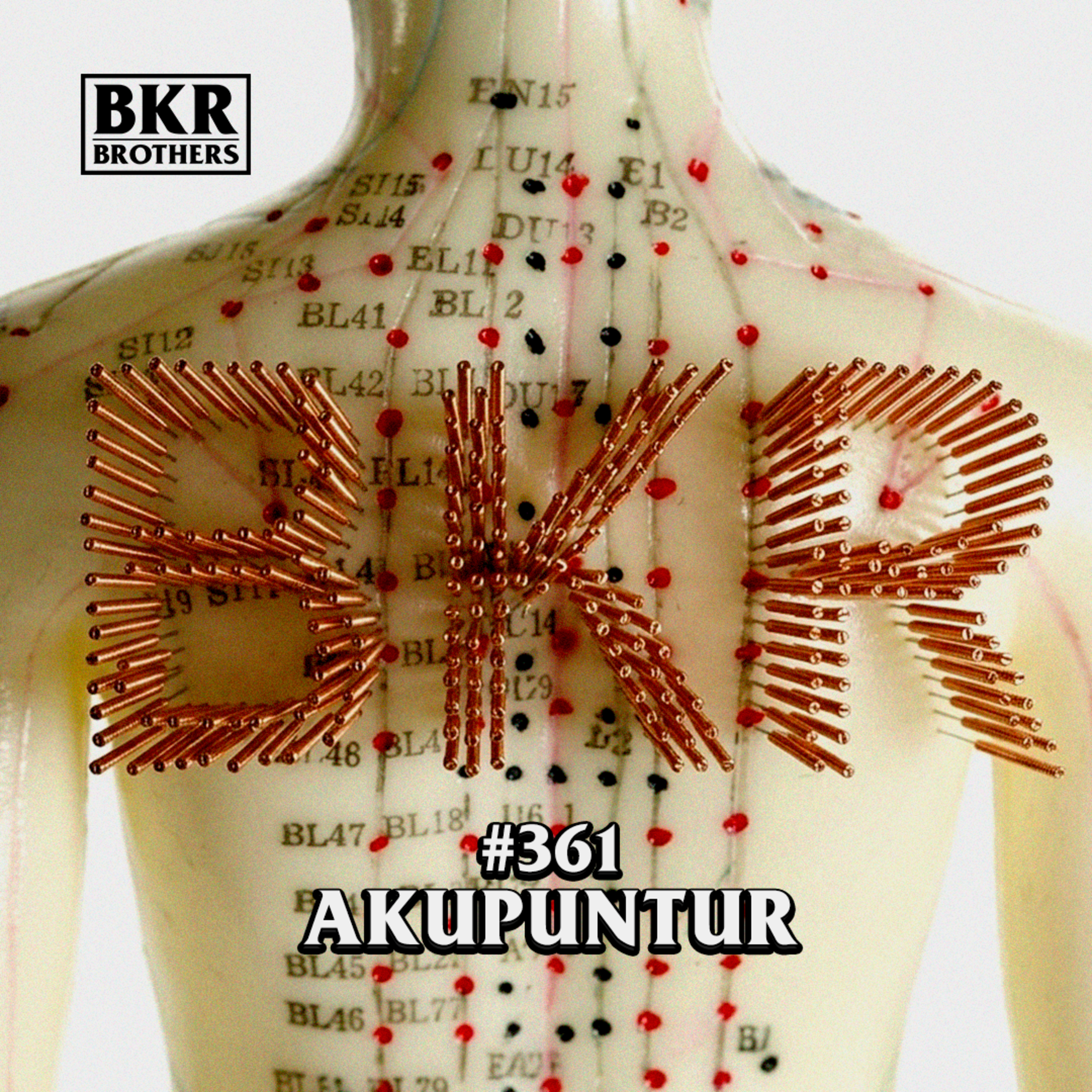 #361 Akupuntur cover art