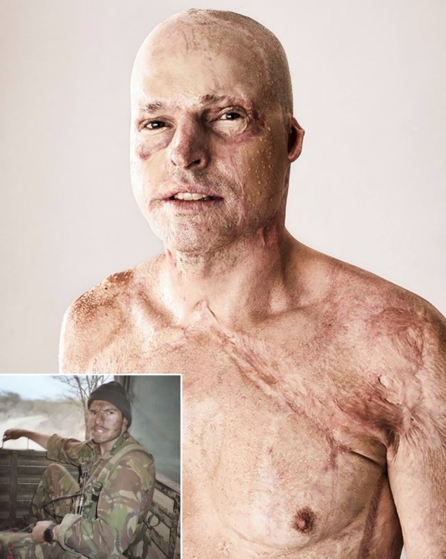 On Fire: The Jamie Hull Story p2 cover art