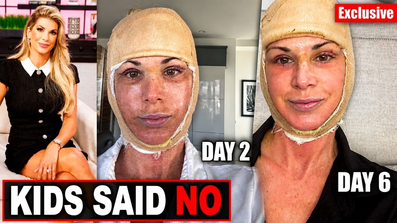 Alexis Bellino Facelift Ahead of 50th Birthday Got Everyone Talking cover art