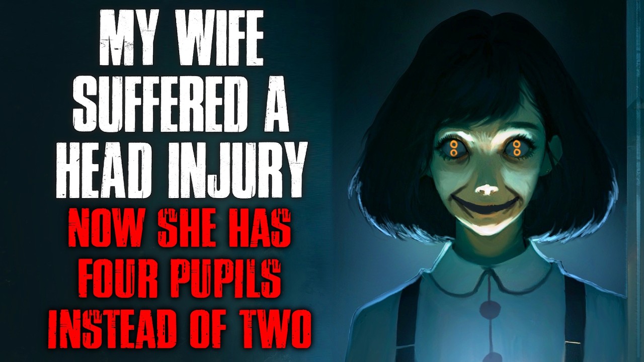 My Wife Suffered a Head Injury. Now She Has Four Pupils Instead of Two. cover art