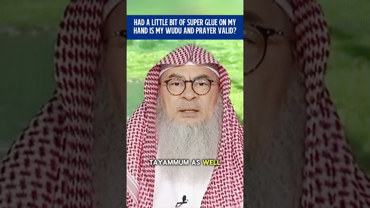 Had a little bit of super glue on my hand, is my wudu & prayer valid? || assim al hakeem cover art