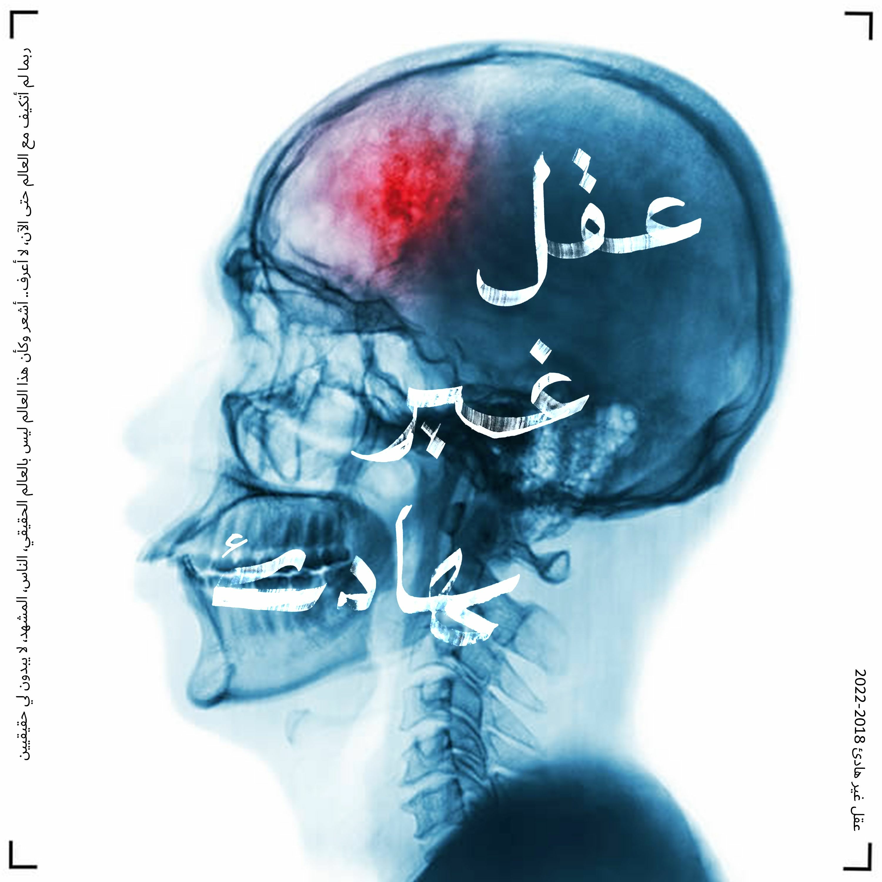 رأيك الذي شنق أحدهم: ثقافة الإقصاء cover art