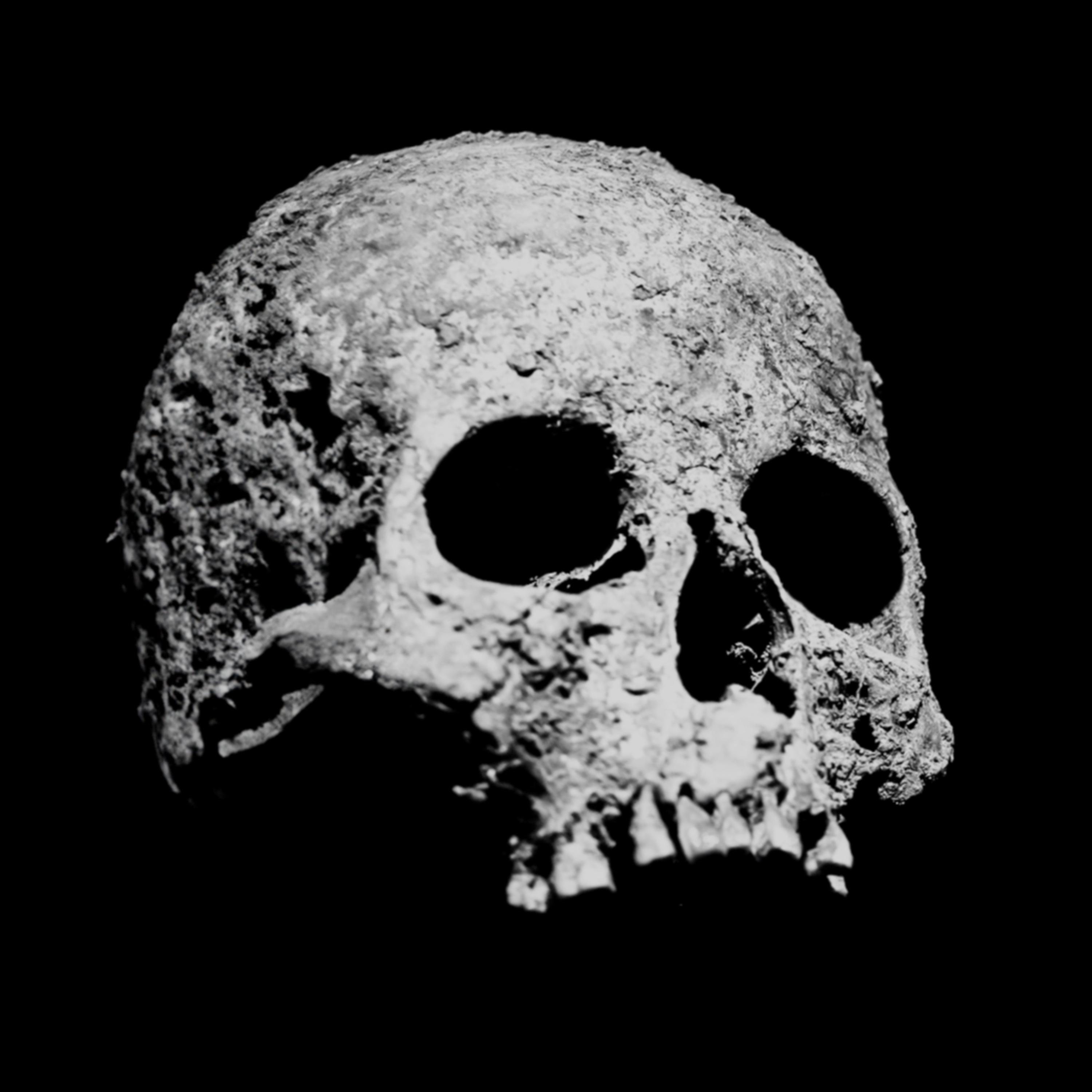 Ossos Perdidos